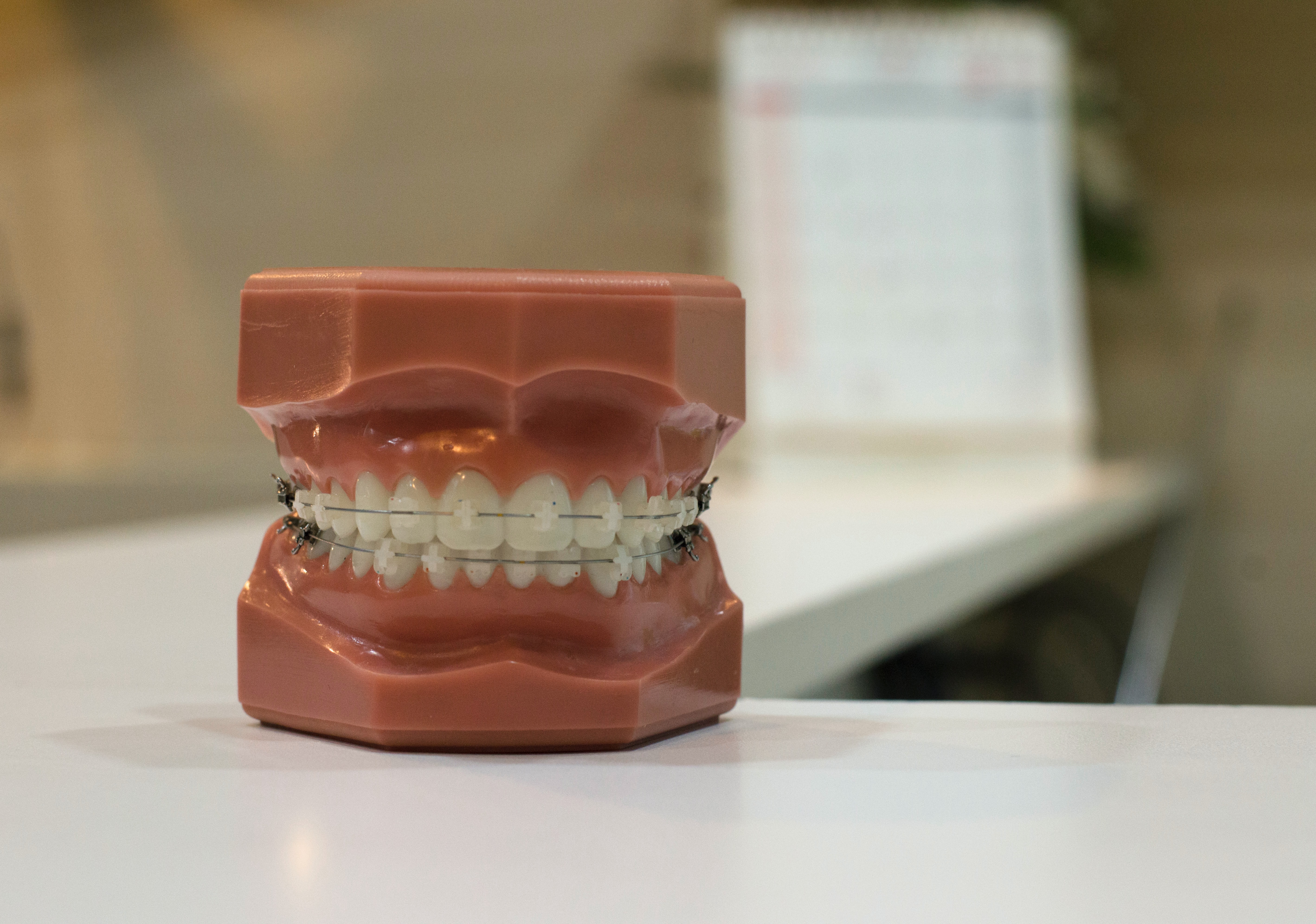 Photograph of model teeth with Orthodontics with tooth colored brackets, Ann Arbor, MI